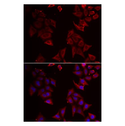 Immunofluorescence - NCR1 antibody from Signalway Antibody (38916) - Antibodies.com