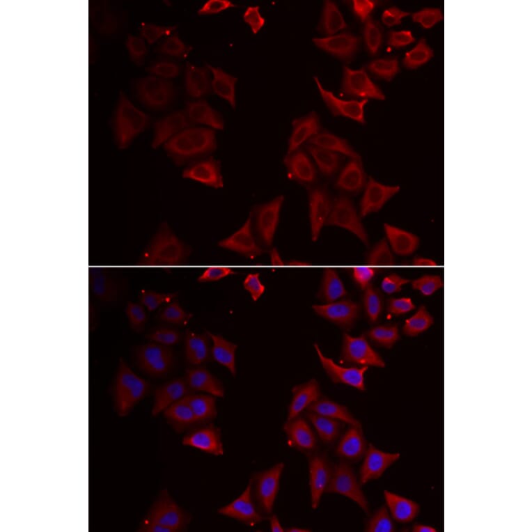 Immunofluorescence - NCR1 antibody from Signalway Antibody (38916) - Antibodies.com