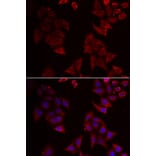 Immunofluorescence - NCR1 antibody from Signalway Antibody (38916) - Antibodies.com