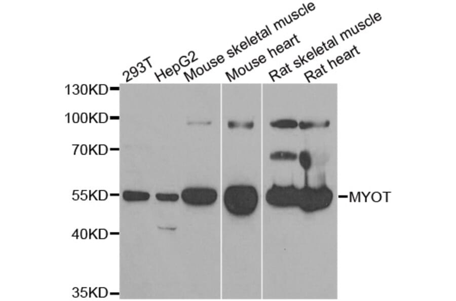 Western blot - MYOT antibody from Signalway Antibody (38917) - Antibodies.com