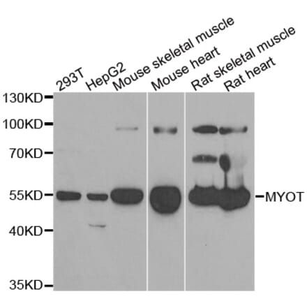 Western blot - MYOT antibody from Signalway Antibody (38917) - Antibodies.com