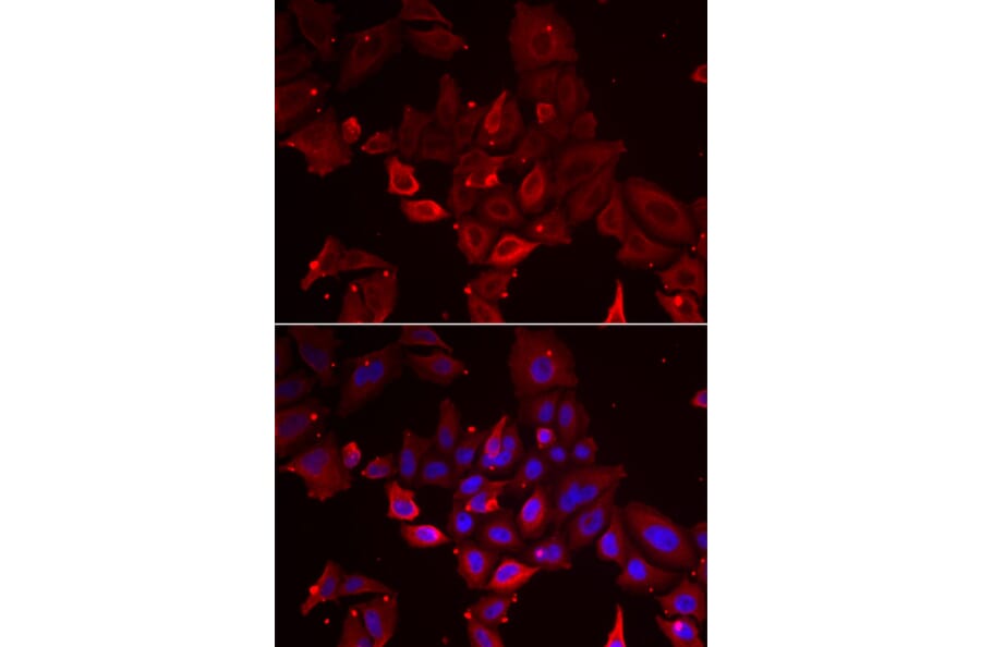 Immunofluorescence - MYOT antibody from Signalway Antibody (38917) - Antibodies.com