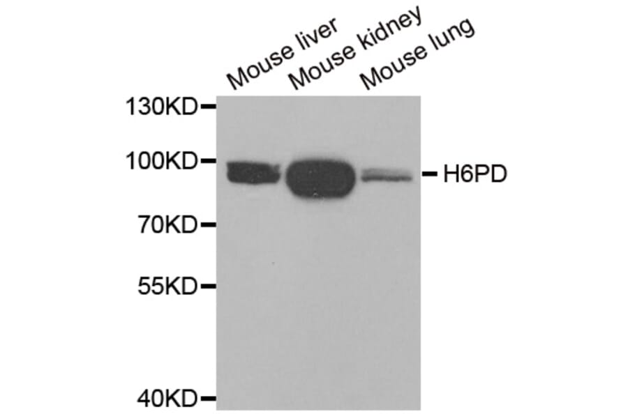 Western blot - H6PD antibody from Signalway Antibody (38918) - Antibodies.com