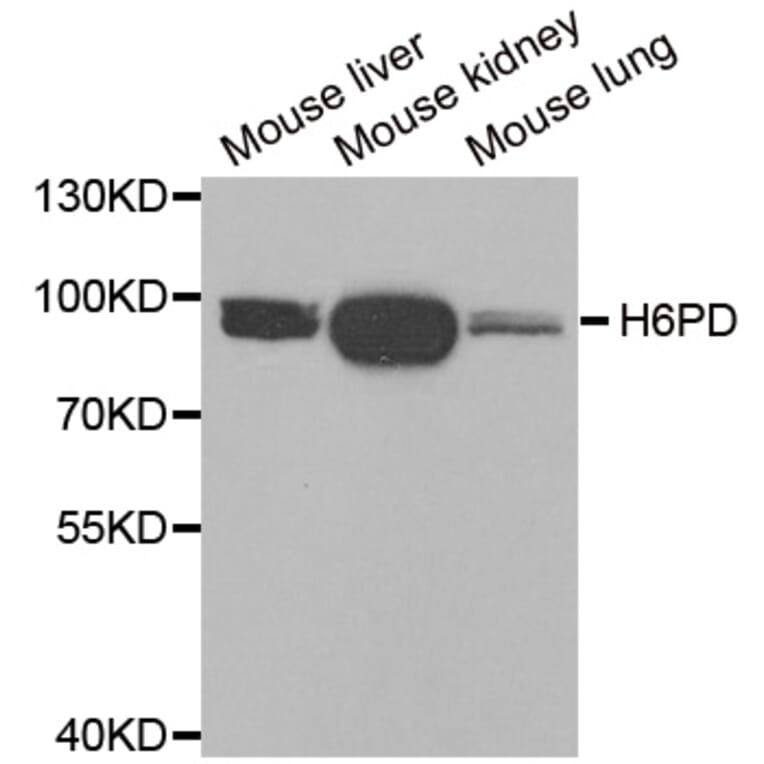 Western blot - H6PD antibody from Signalway Antibody (38918) - Antibodies.com
