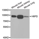 Western blot - H6PD antibody from Signalway Antibody (38918) - Antibodies.com