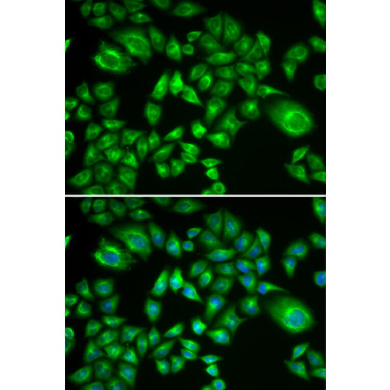 Immunofluorescence - H6PD antibody from Signalway Antibody (38918) - Antibodies.com