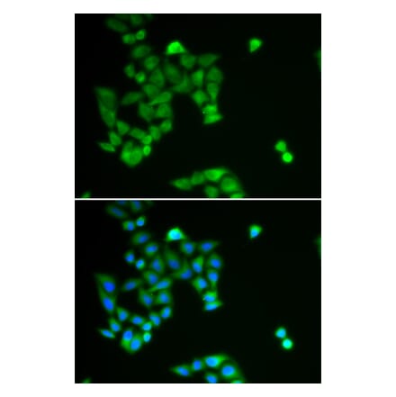 Immunofluorescence - PJA2 antibody from Signalway Antibody (38922) - Antibodies.com