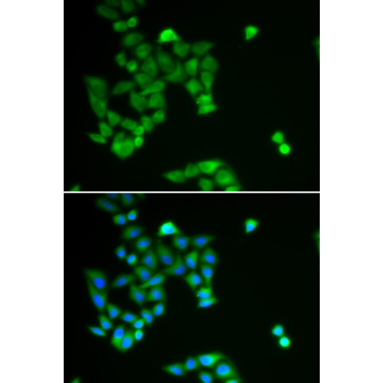 Immunofluorescence - PJA2 antibody from Signalway Antibody (38922) - Antibodies.com