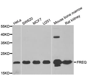Western blot - NCS1 antibody from Signalway Antibody (38932) - Antibodies.com