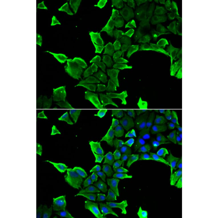 Immunofluorescence - NCS1 antibody from Signalway Antibody (38932) - Antibodies.com