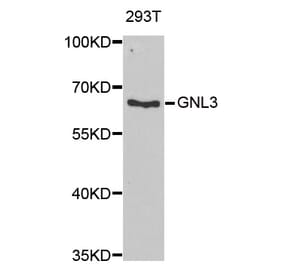 Western blot - GNL3 antibody from Signalway Antibody (38936) - Antibodies.com