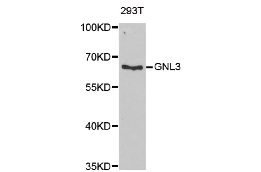 Western blot - GNL3 antibody from Signalway Antibody (38936) - Antibodies.com