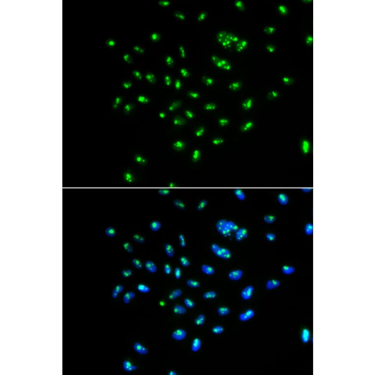 Immunofluorescence - GNL3 antibody from Signalway Antibody (38936) - Antibodies.com