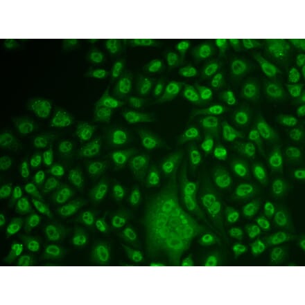 Immunofluorescence - TFPT antibody from Signalway Antibody (38938) - Antibodies.com