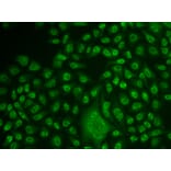 Immunofluorescence - TFPT antibody from Signalway Antibody (38938) - Antibodies.com