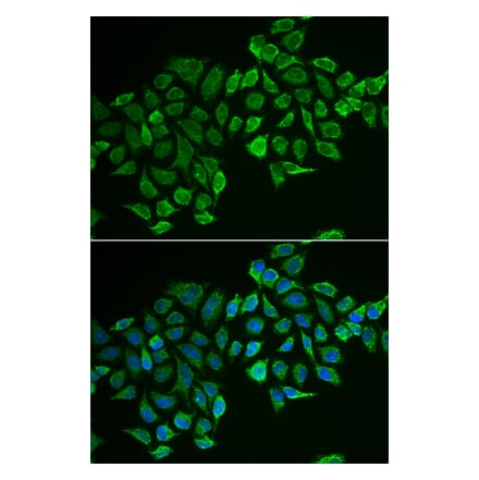 Immunofluorescence - RHOD antibody from Signalway Antibody (38940) - Antibodies.com