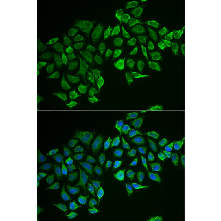 Immunofluorescence - RHOD antibody from Signalway Antibody (38940) - Antibodies.com