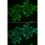 Immunofluorescence - RHOD antibody from Signalway Antibody (38940) - Antibodies.com