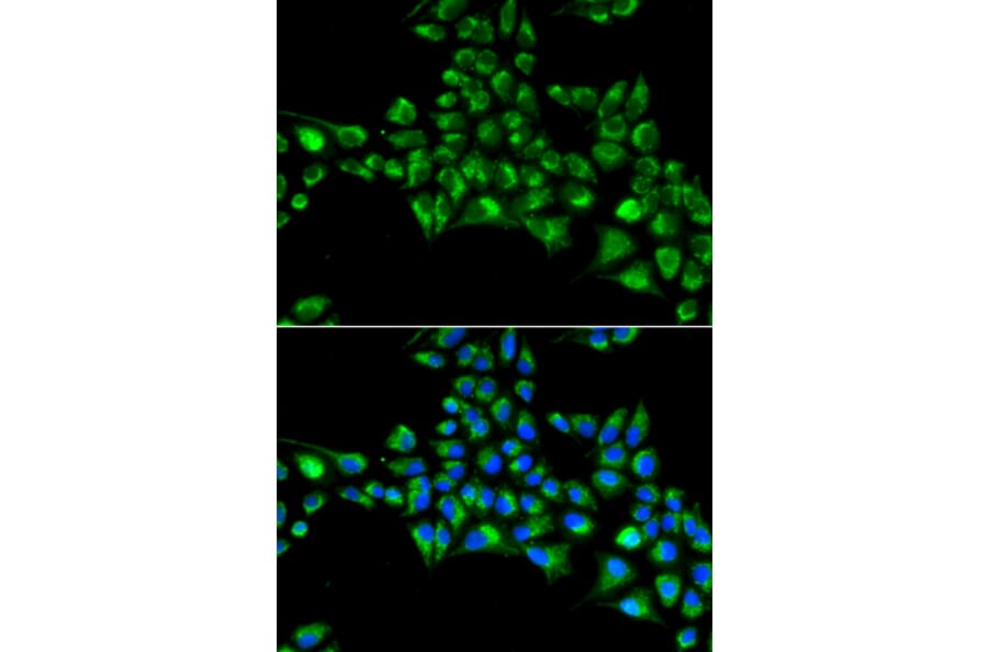 Immunofluorescence - CYGB antibody from Signalway Antibody (38960) - Antibodies.com