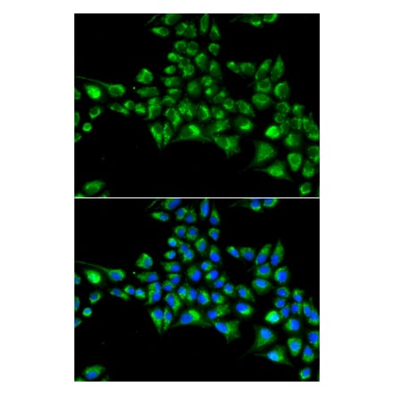 Immunofluorescence - CYGB antibody from Signalway Antibody (38960) - Antibodies.com