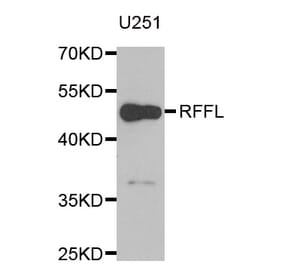 Western blot - RFFL antibody from Signalway Antibody (38961) - Antibodies.com