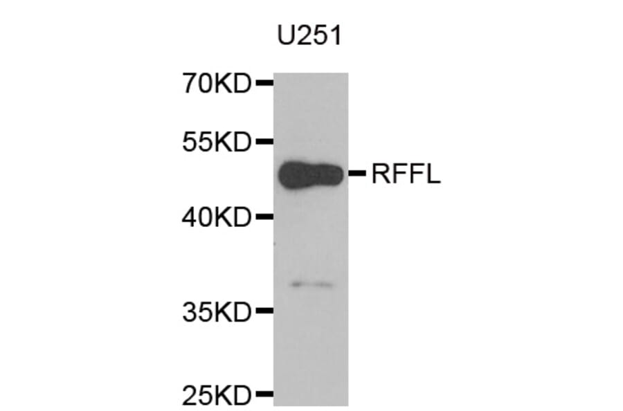 Western blot - RFFL antibody from Signalway Antibody (38961) - Antibodies.com
