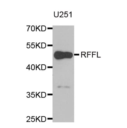 Western blot - RFFL antibody from Signalway Antibody (38961) - Antibodies.com