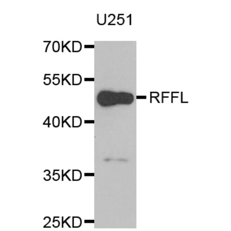 Western blot - RFFL antibody from Signalway Antibody (38961) - Antibodies.com
