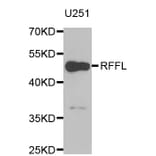 Western blot - RFFL antibody from Signalway Antibody (38961) - Antibodies.com