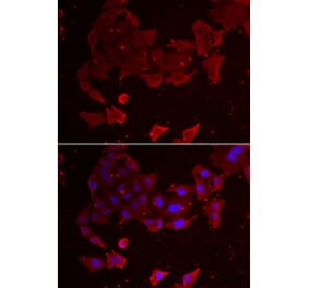 Immunofluorescence - FLCN antibody from Signalway Antibody (38963) - Antibodies.com