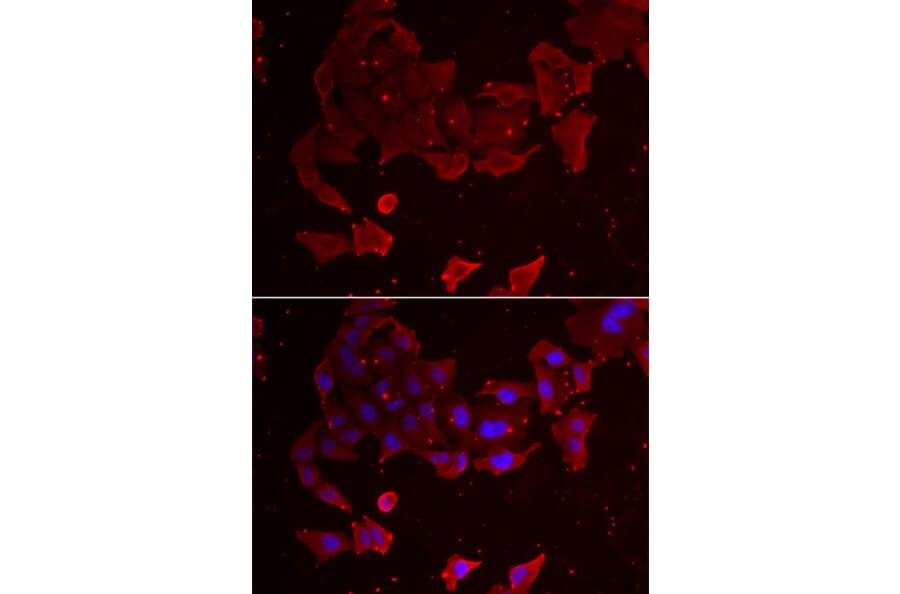 Immunofluorescence - FLCN antibody from Signalway Antibody (38963) - Antibodies.com