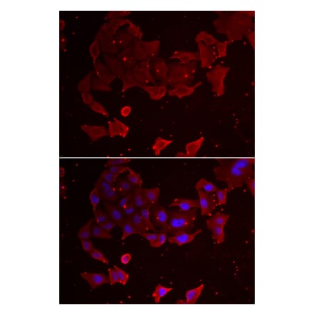 Immunofluorescence - FLCN antibody from Signalway Antibody (38963) - Antibodies.com