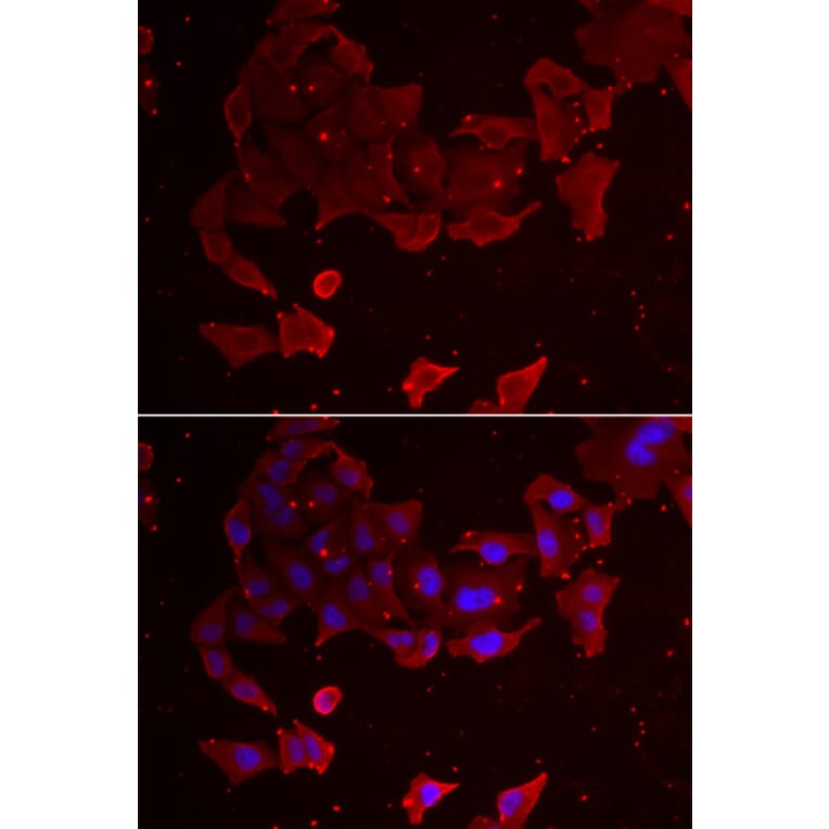 Immunofluorescence - FLCN antibody from Signalway Antibody (38963) - Antibodies.com