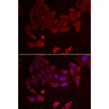 Immunofluorescence - FLCN antibody from Signalway Antibody (38963) - Antibodies.com