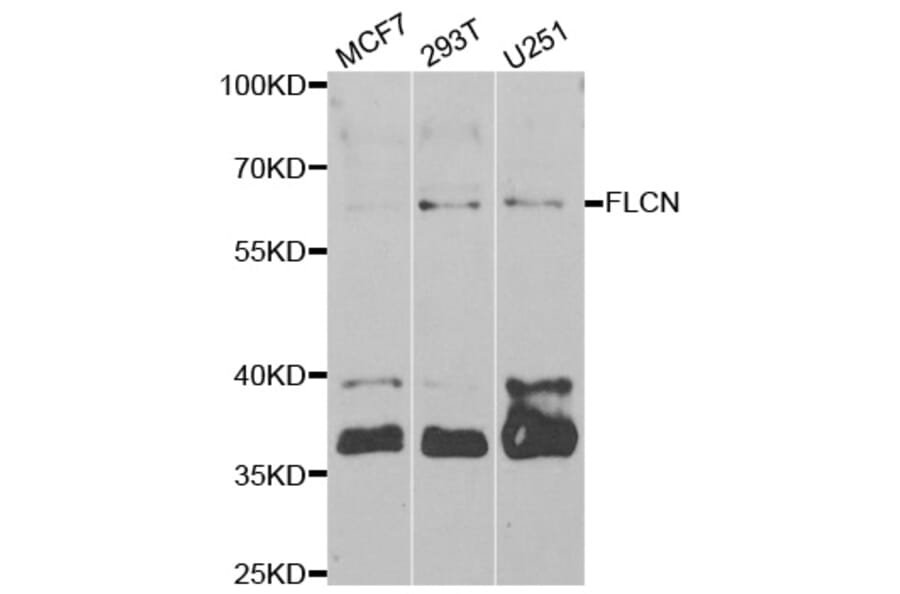 Western blot - FLCN antibody from Signalway Antibody (38963) - Antibodies.com