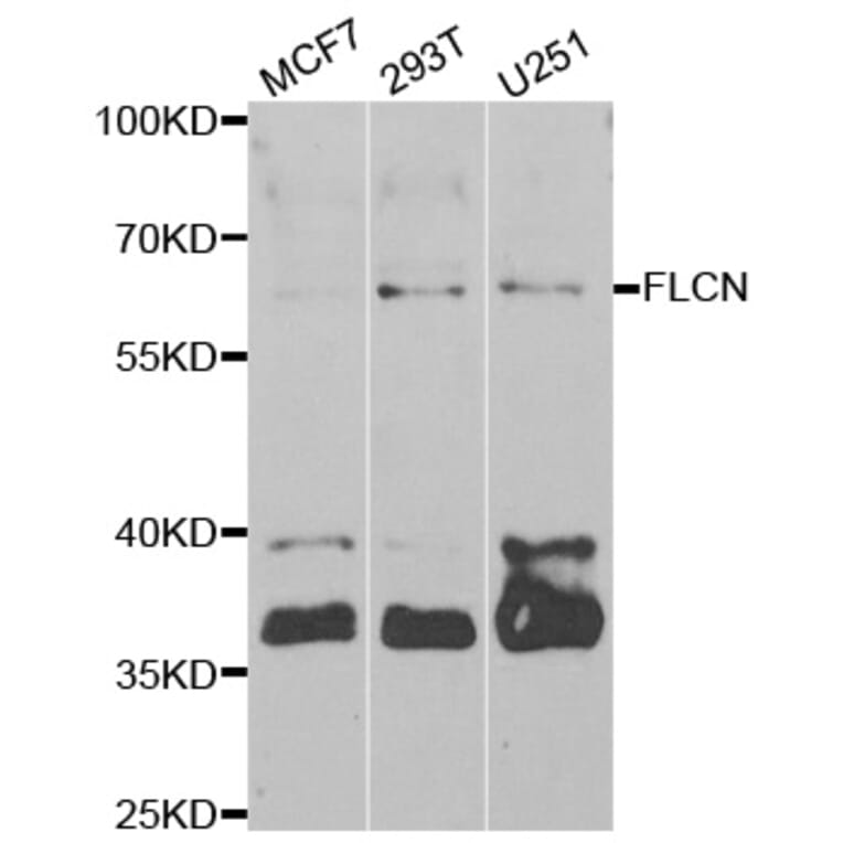 Western blot - FLCN antibody from Signalway Antibody (38963) - Antibodies.com
