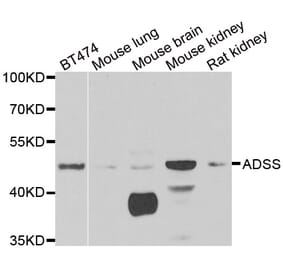 Western blot - ADSS antibody from Signalway Antibody (38970) - Antibodies.com