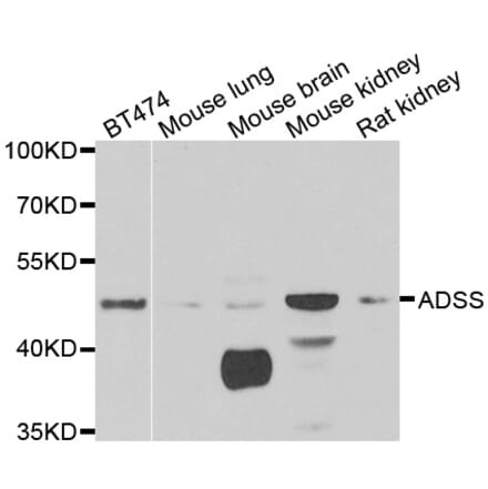 Western blot - ADSS antibody from Signalway Antibody (38970) - Antibodies.com