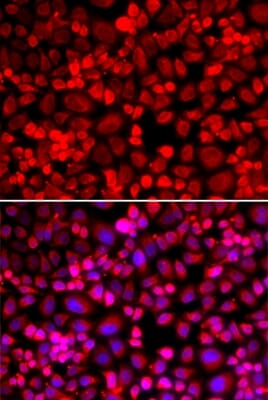 Immunofluorescence analysis of HeLa cell using ANLN antibody. Blue: DAPI for nuclear staining.