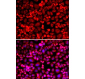 Immunofluorescence - ANLN antibody from Signalway Antibody (38978) - Antibodies.com