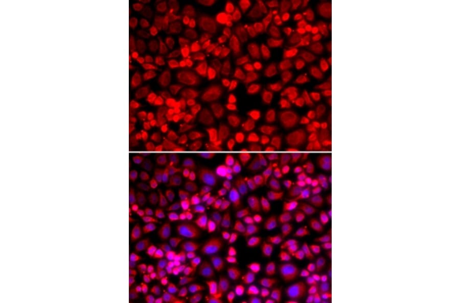 Immunofluorescence - ANLN antibody from Signalway Antibody (38978) - Antibodies.com