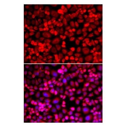 Immunofluorescence - ANLN antibody from Signalway Antibody (38978) - Antibodies.com