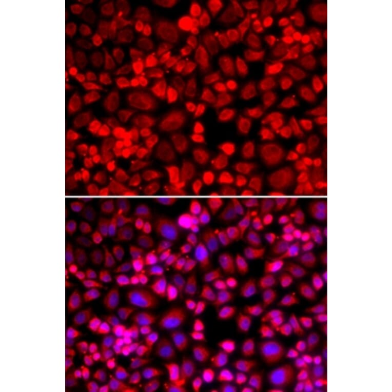 Immunofluorescence - ANLN antibody from Signalway Antibody (38978) - Antibodies.com