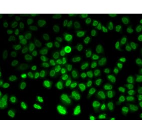 Immunofluorescence - ASMT antibody from Signalway Antibody (38982) - Antibodies.com