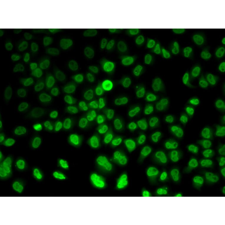 Immunofluorescence - ASMT antibody from Signalway Antibody (38982) - Antibodies.com