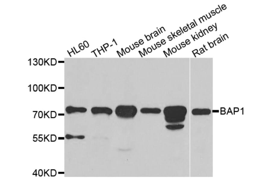 Western blot - BAP1 antibody from Signalway Antibody (38986) - Antibodies.com