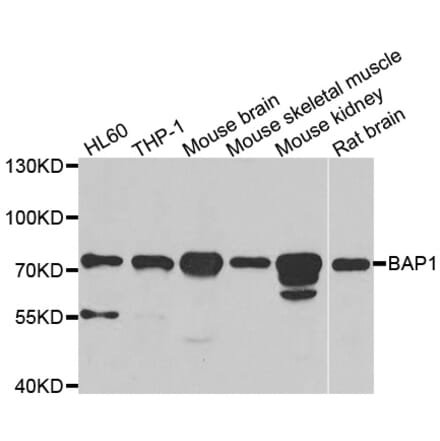 Western blot - BAP1 antibody from Signalway Antibody (38986) - Antibodies.com