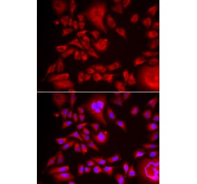 Immunofluorescence - BLMH antibody from Signalway Antibody (38988) - Antibodies.com
