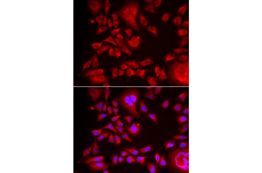 Immunofluorescence - BLMH antibody from Signalway Antibody (38988) - Antibodies.com