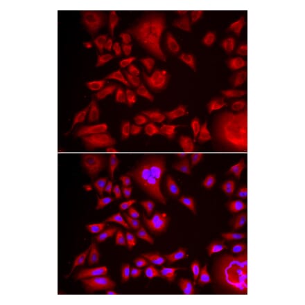 Immunofluorescence - BLMH antibody from Signalway Antibody (38988) - Antibodies.com